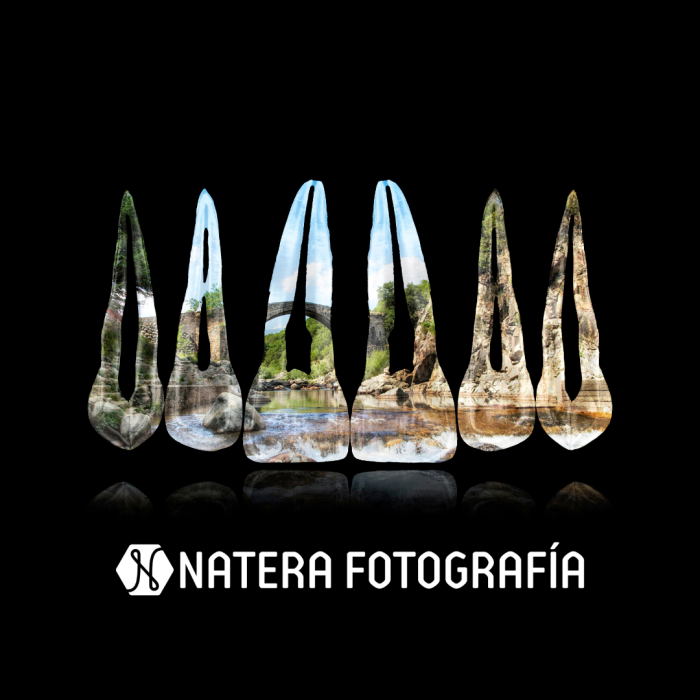 Composición de dientes. La Vera, Cáceres