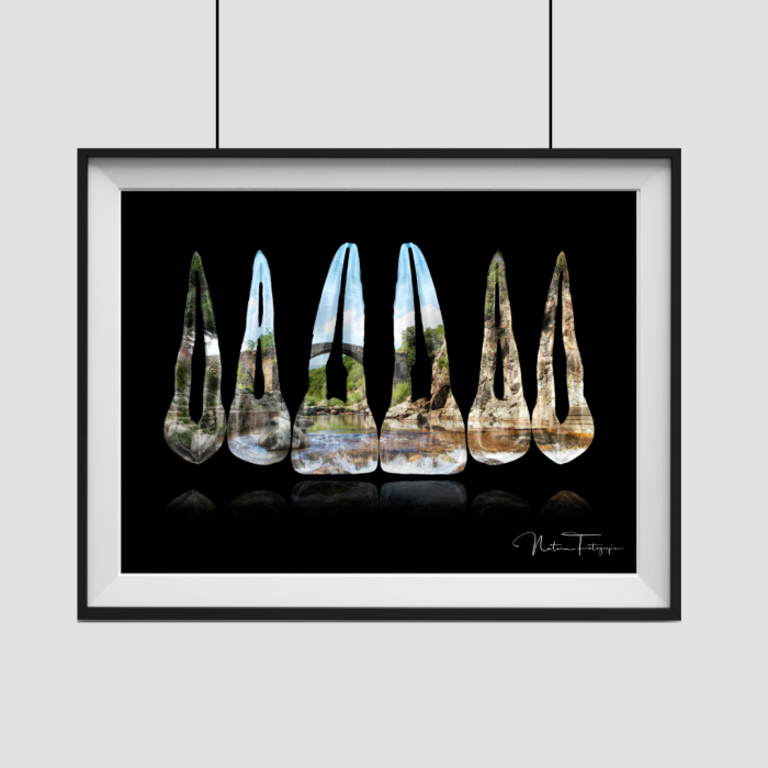 Composición de dientes. La Vera, Cáceres - Imagen 2