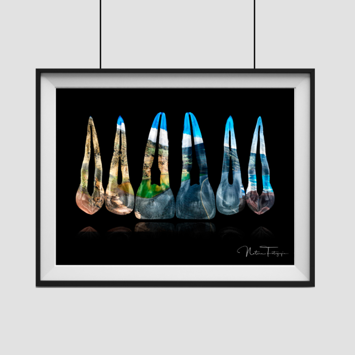 Composición de dientes. Lanzarote - Imagen 2