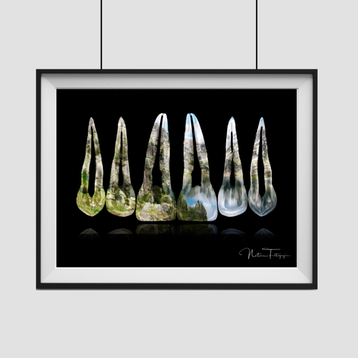 Composición de dientes. Parque nacional Aigüestortes, Lleida - Imagen 2