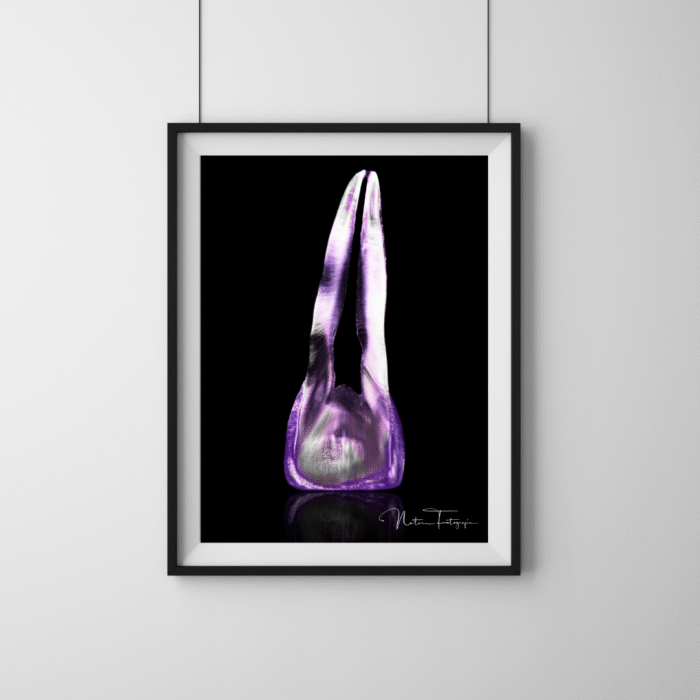 Central morado - 8045