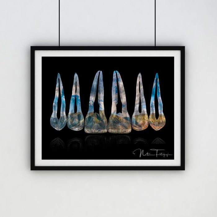 Composición de dientes. Ávila, Venezuela