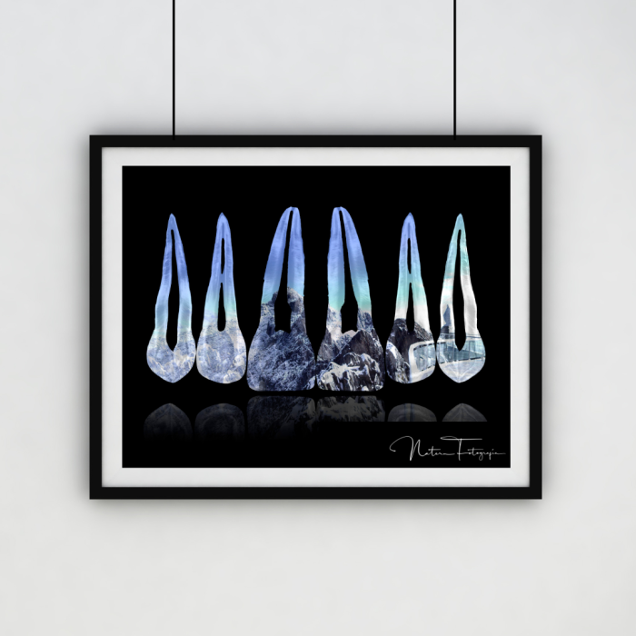 Composición de dientes. Pico Espejo, Venezuela