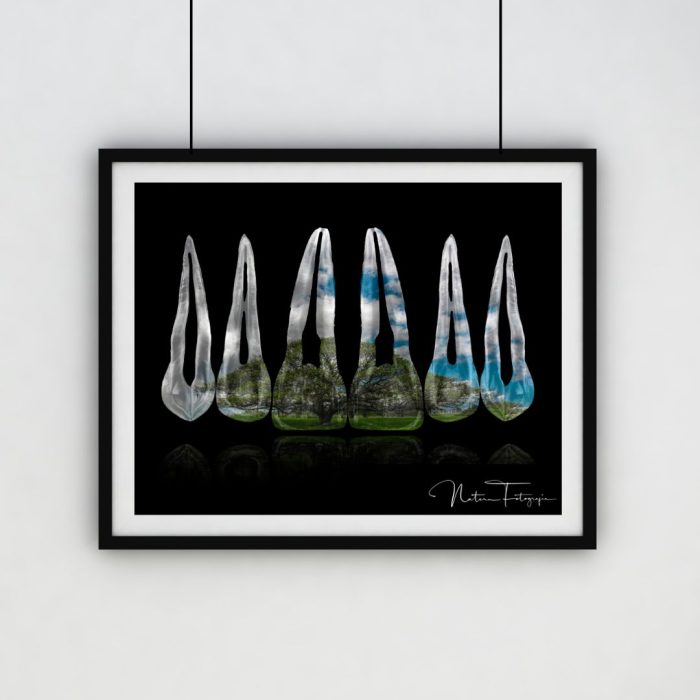 Composición de dientes. Samán, Venezuela