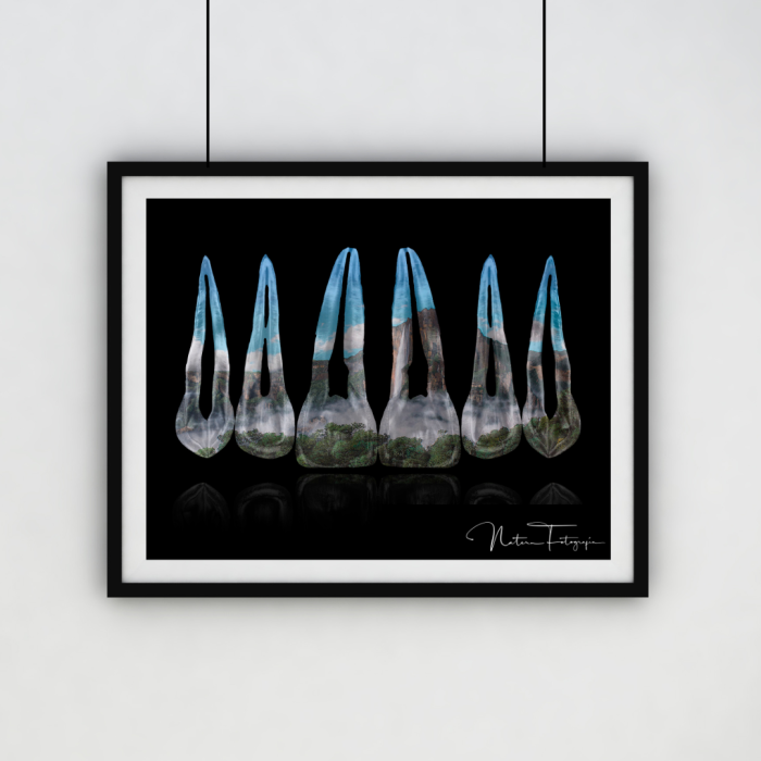 Composición de dientes. Salto Ángel, Venezuela
