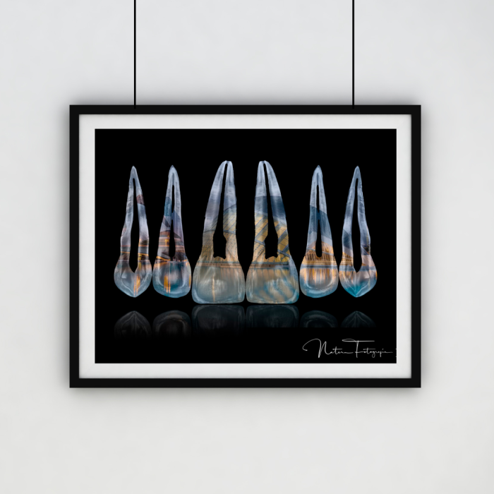 Composición de dientes. Ciudad de las Artes, Valencia 1
