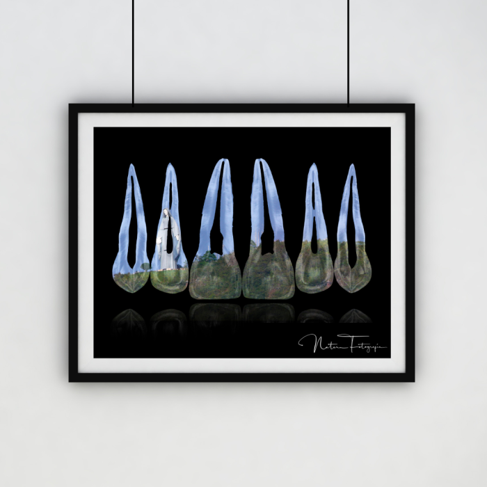 Composición de dientes. Virgen de la Paz, Trujillo